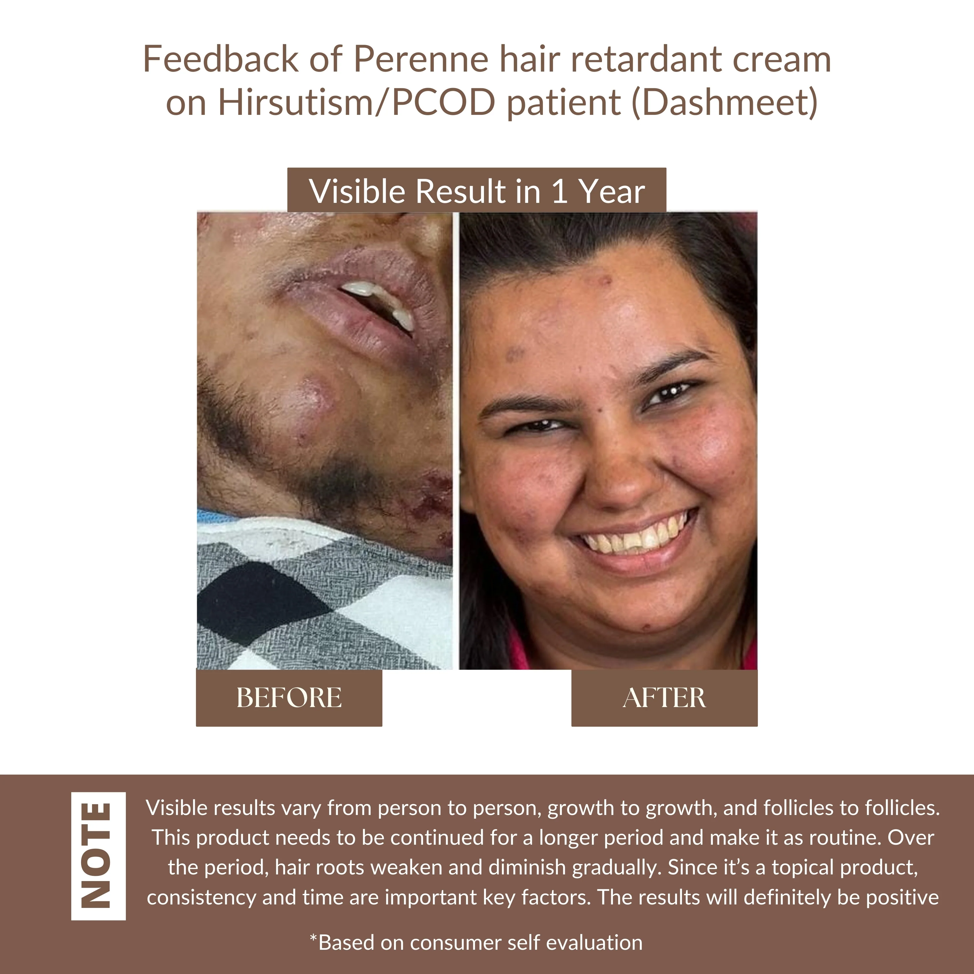 Perenne Hair Retardant Cream | Reduces Unwanted Face Hair Growth | Dermatologist-Tested & Clinically Proven Formula | Natural & Paraben-Free | Safe for Face & Body | For Women & Men - Image 11