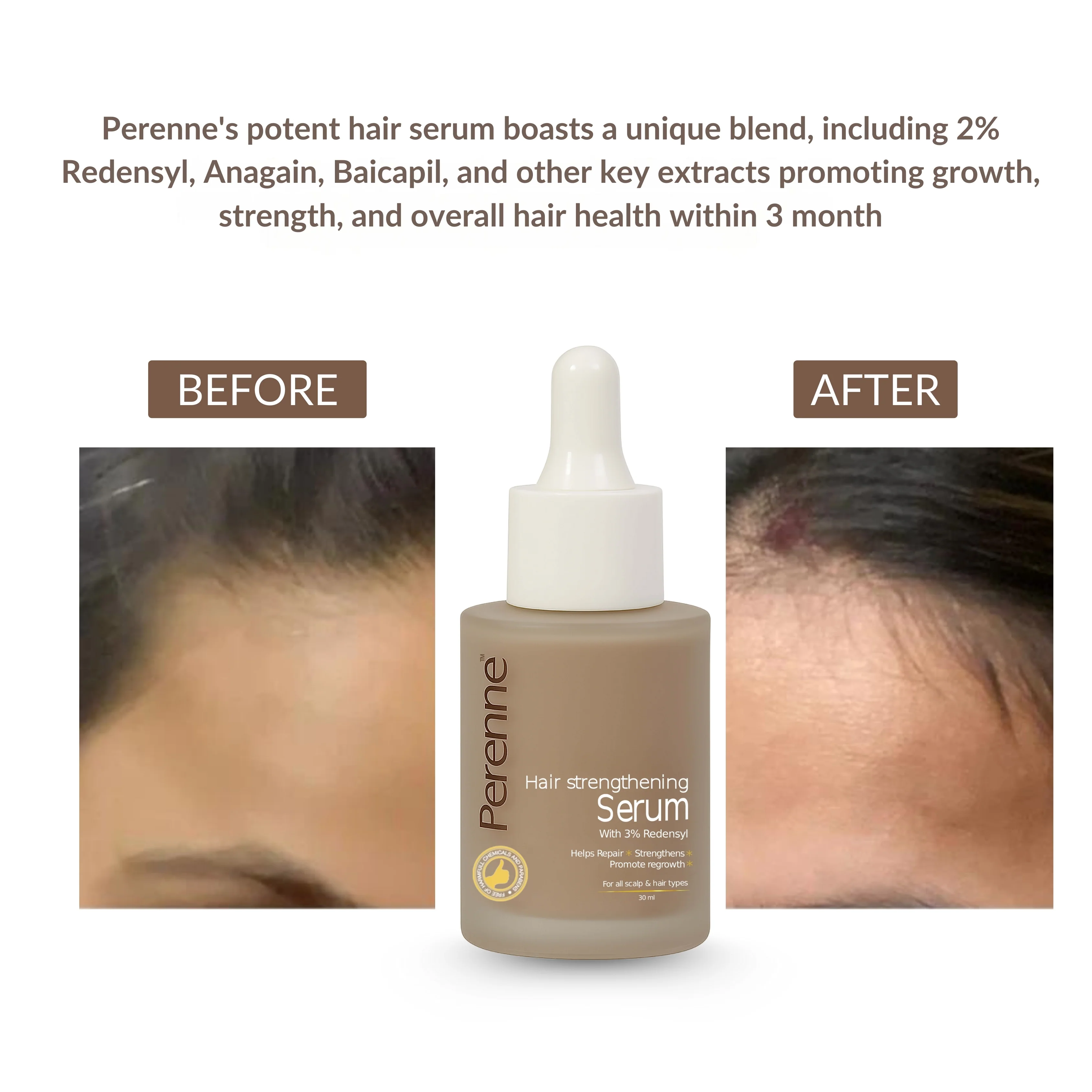 Perenne Hair Strengthening Serum | Hair Fall Control, Hair Growth & Regrowth | Redensyl, Bicapil & Anagain | Sulphate & Paraben Free | All Hair Types - Image 6