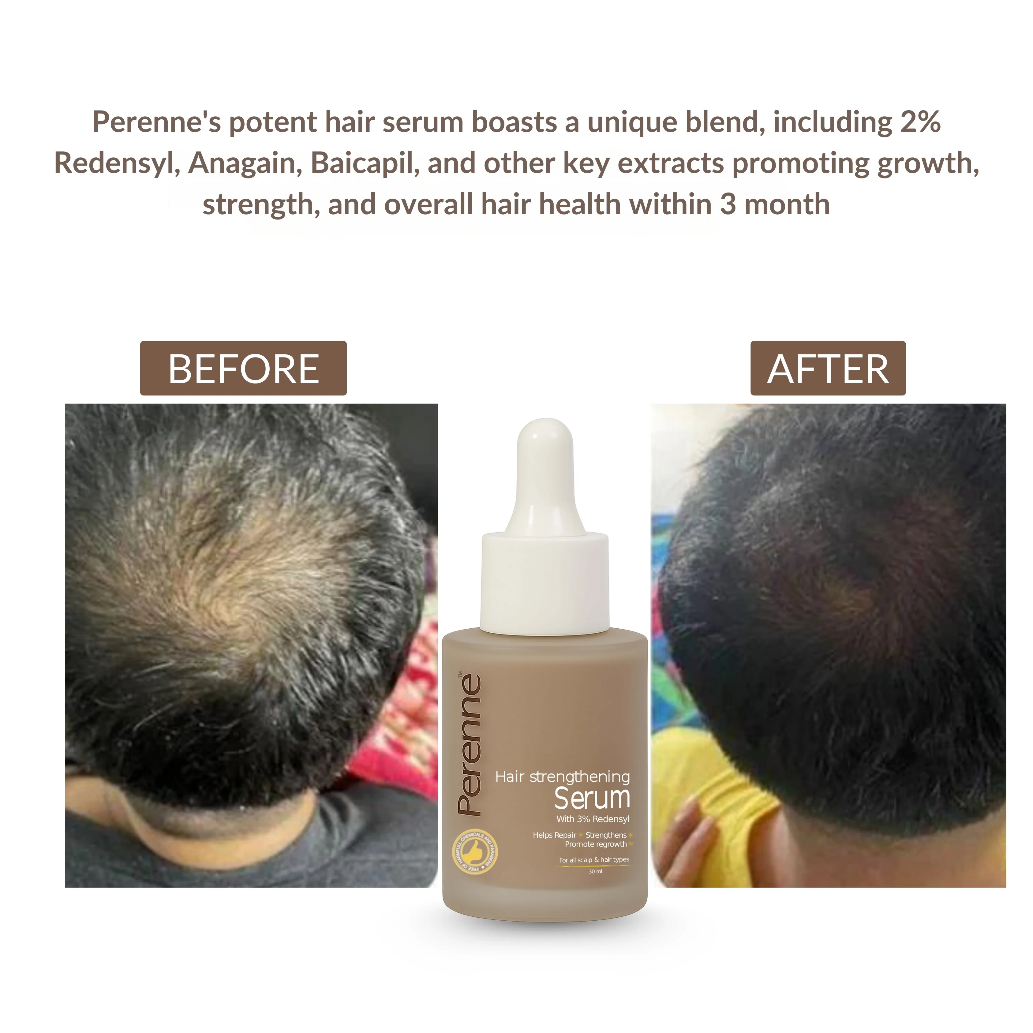 Perenne Hair Strengthening Serum | Hair Fall Control, Hair Growth & Regrowth | Redensyl, Bicapil & Anagain | Sulphate & Paraben Free | All Hair Types - Image 9